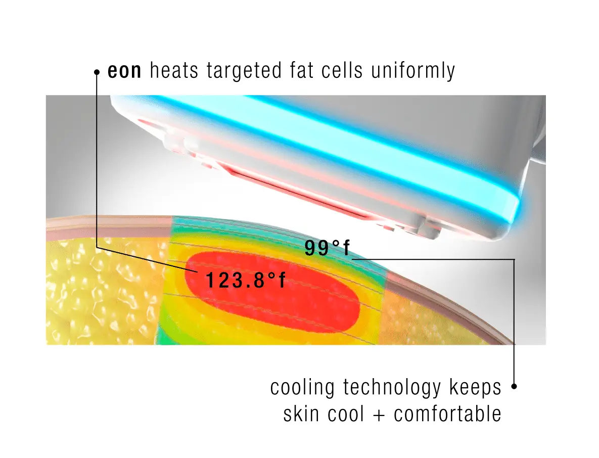 Skinney Medspa Treatments