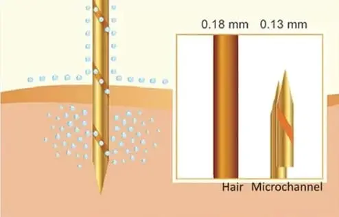 Skinney Medspa Treatments