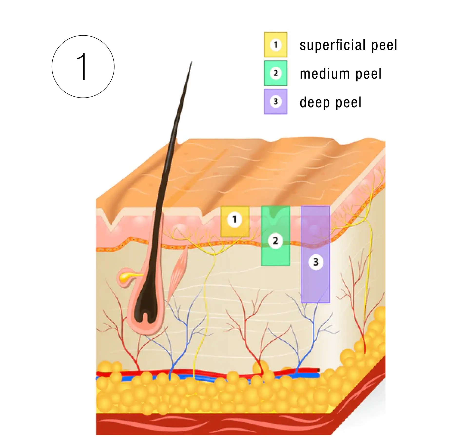 Skinney Medspa Treatments
