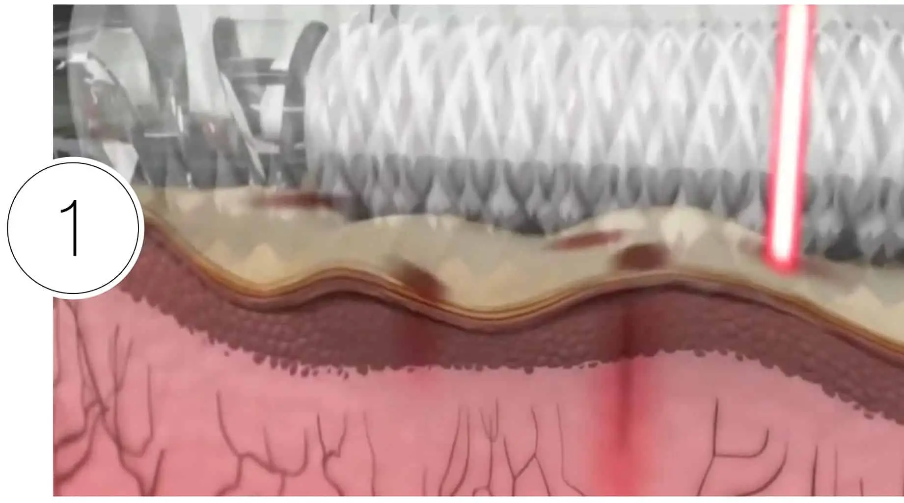 Skinney Medspa Treatments