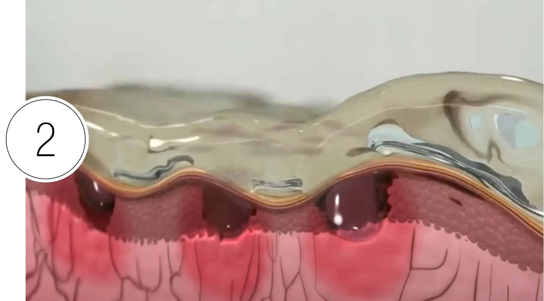 Skinney Medspa Treatments