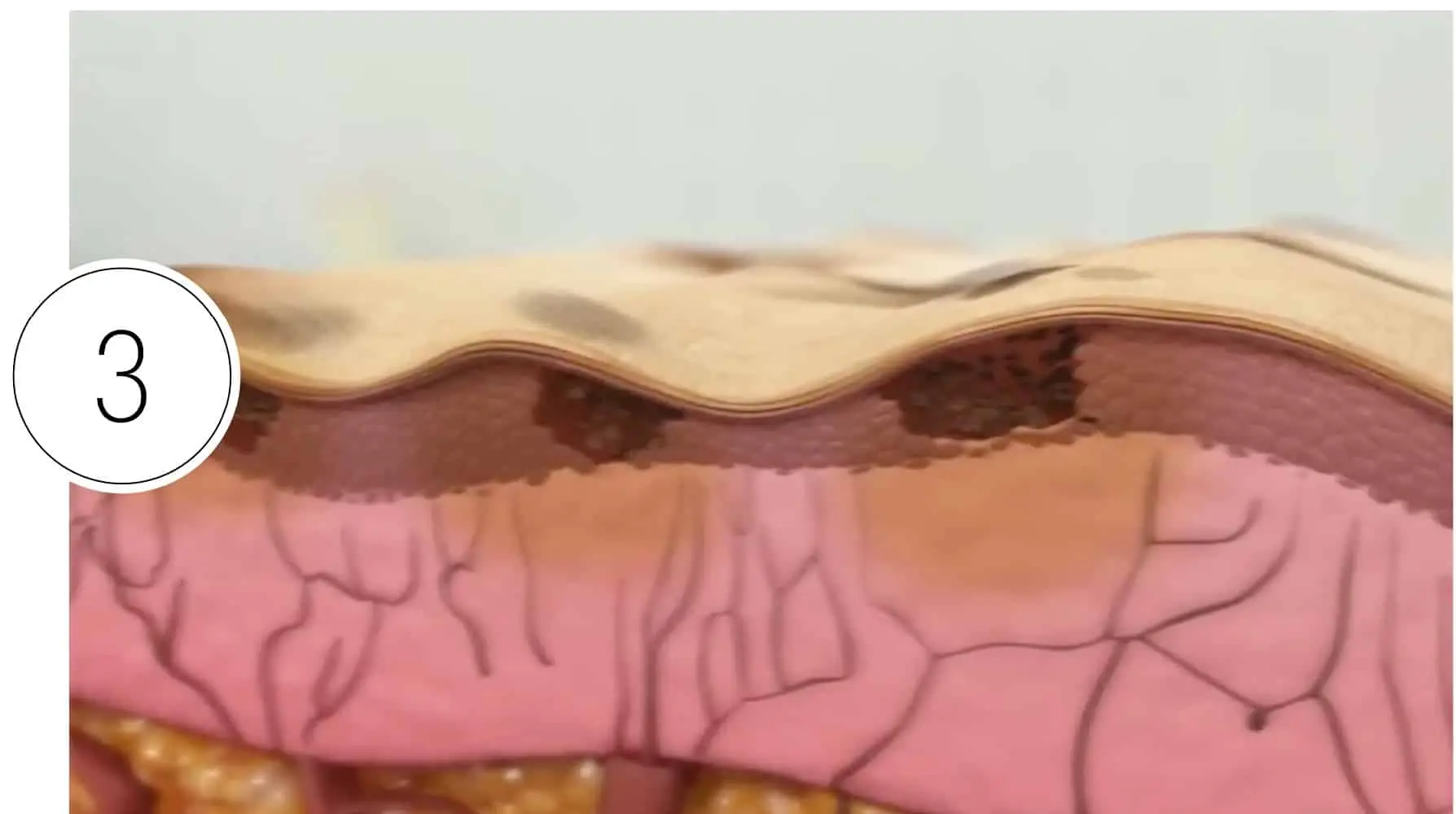 Skinney Medspa Treatments