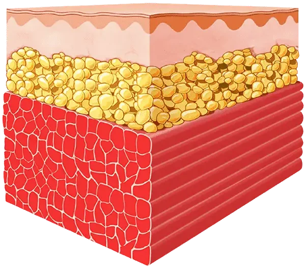 How Emsculpt NYC Works After Treatment Diagram