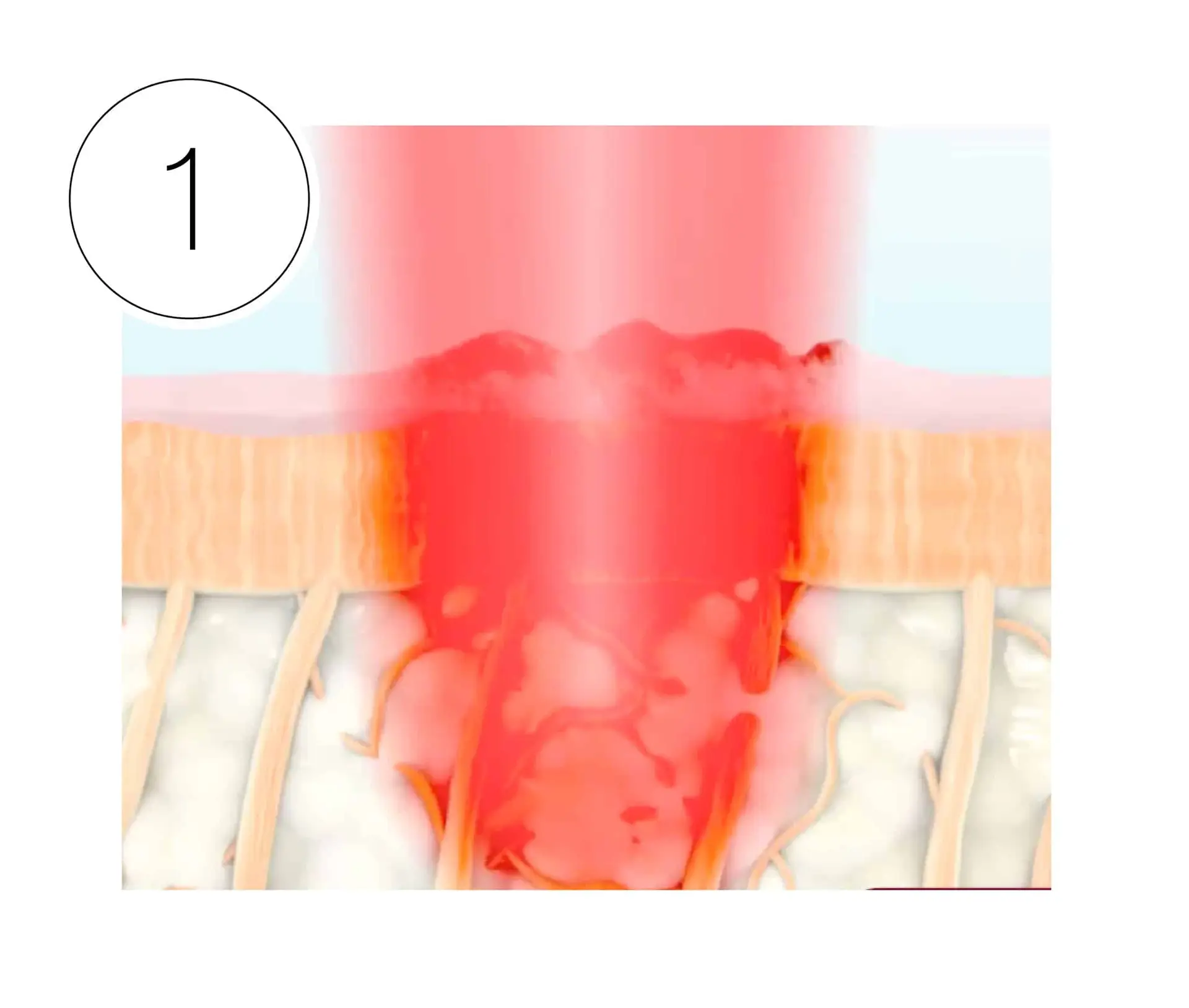 Skinney Medspa Treatments