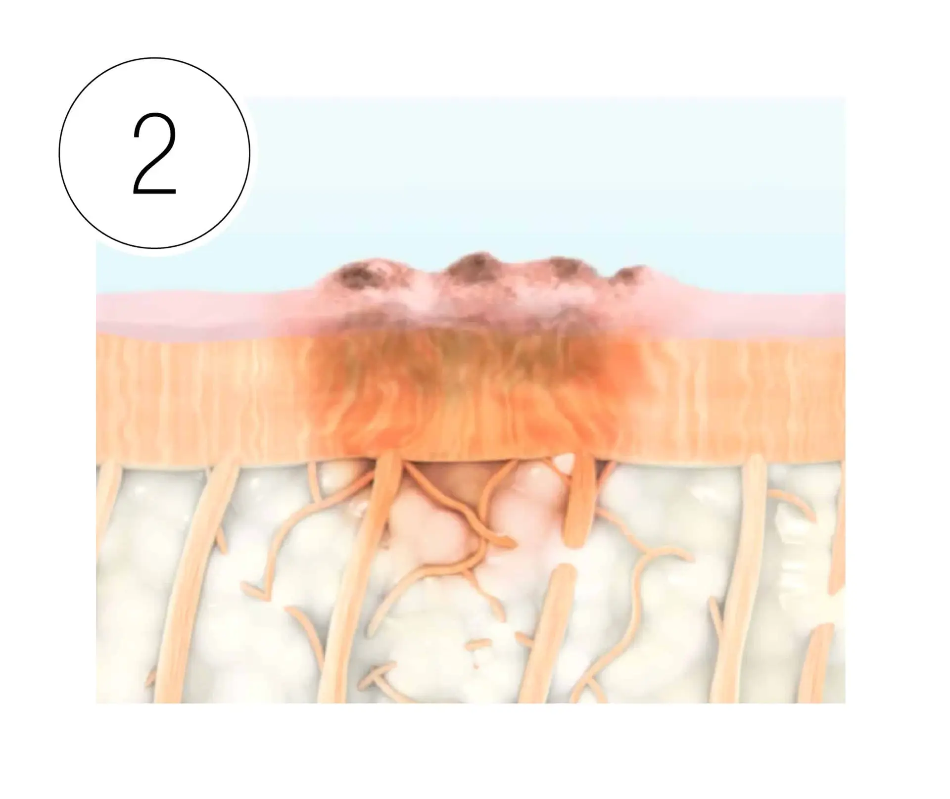 Skinney Medspa Treatments