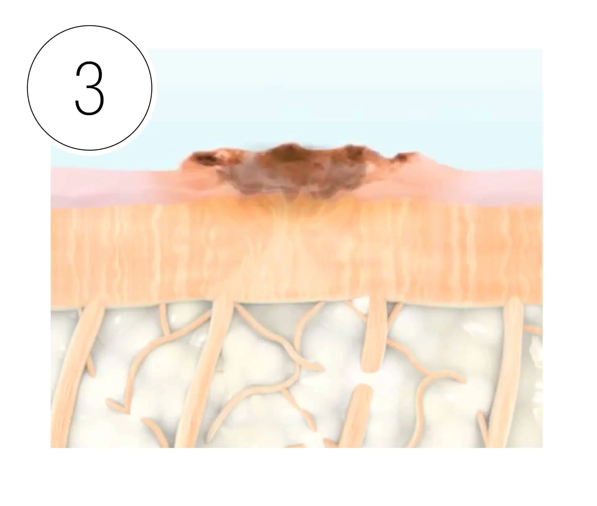 Skinney Medspa Treatments