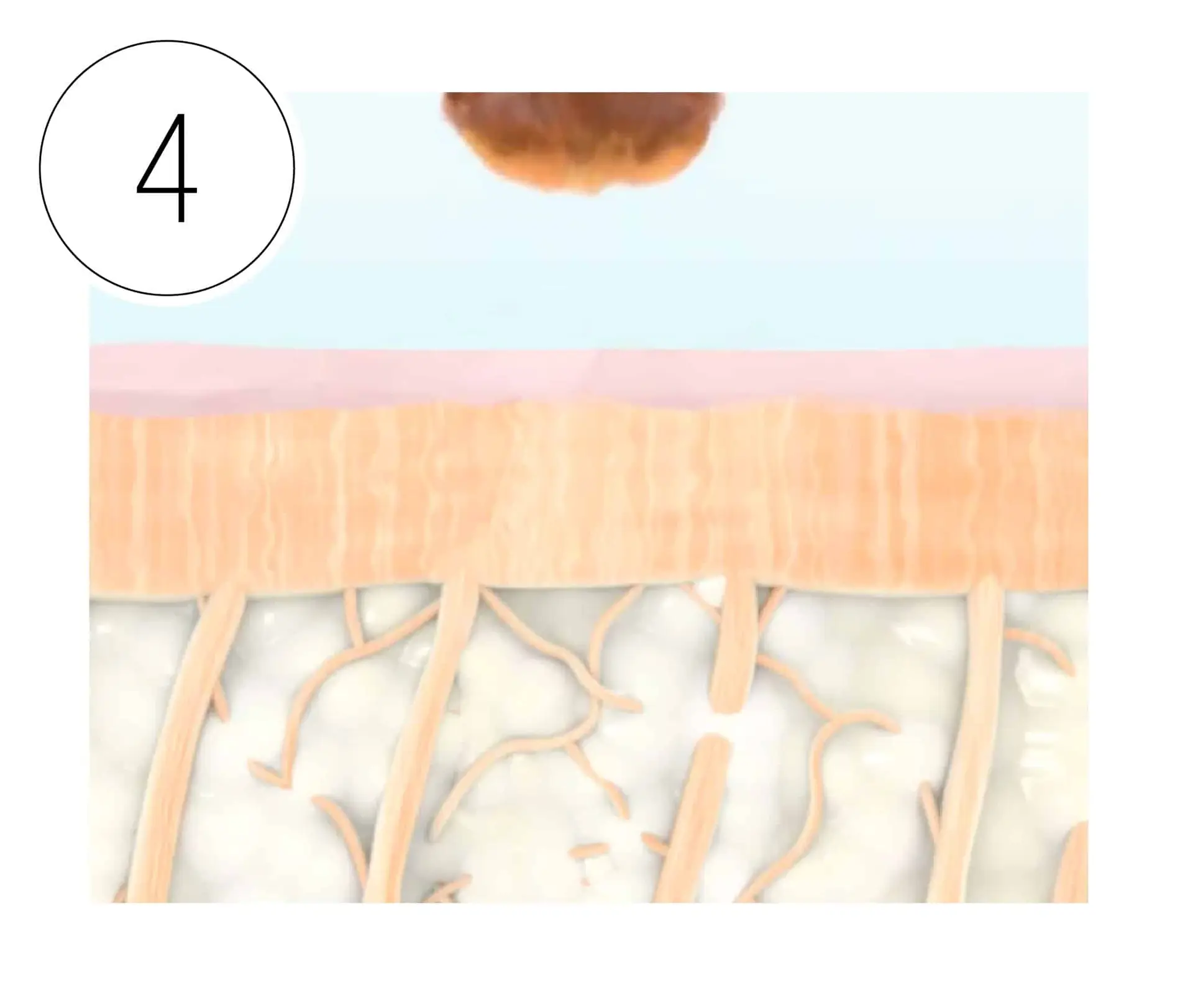 Skinney Medspa Treatments