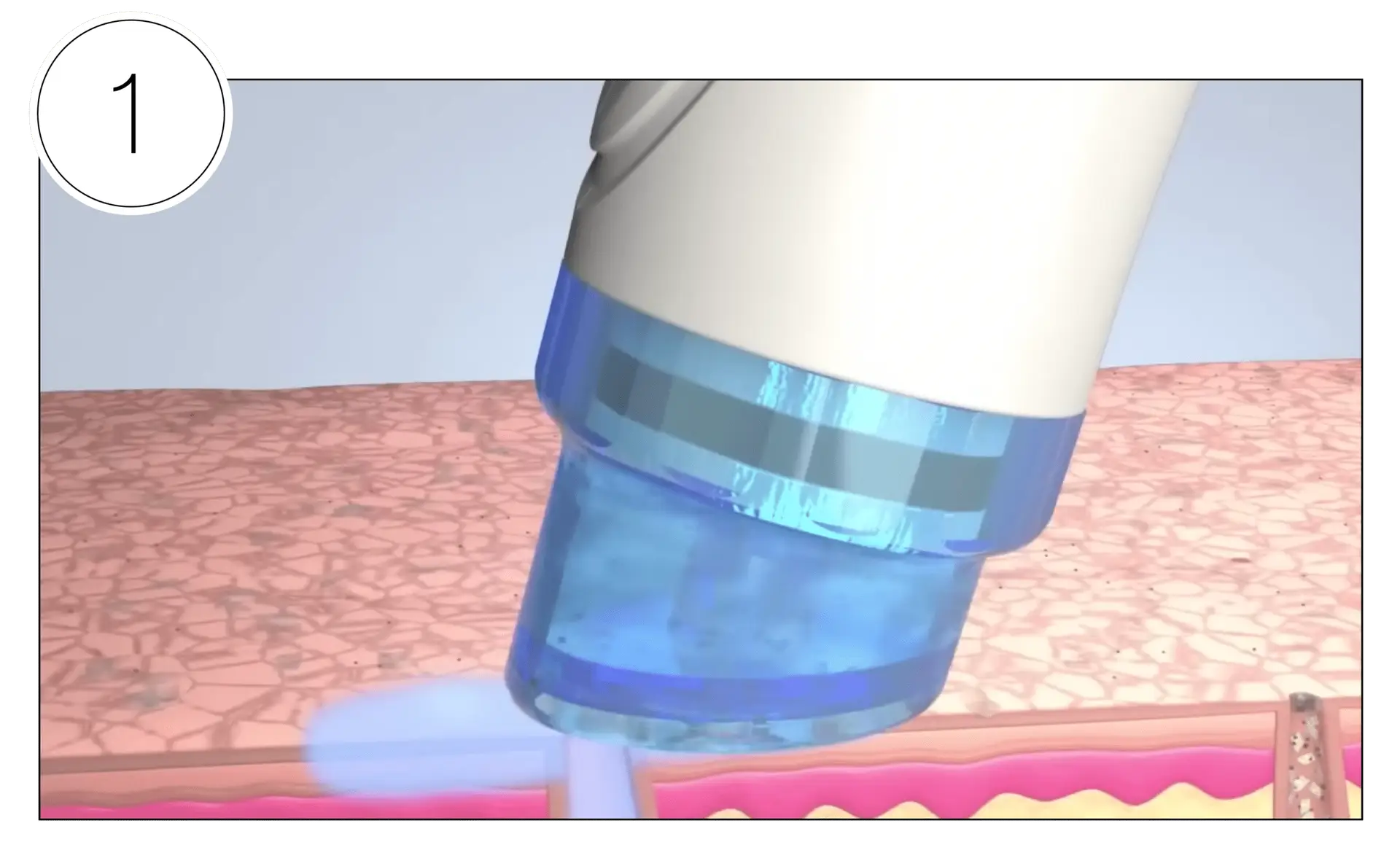 Skinney Medspa Treatments