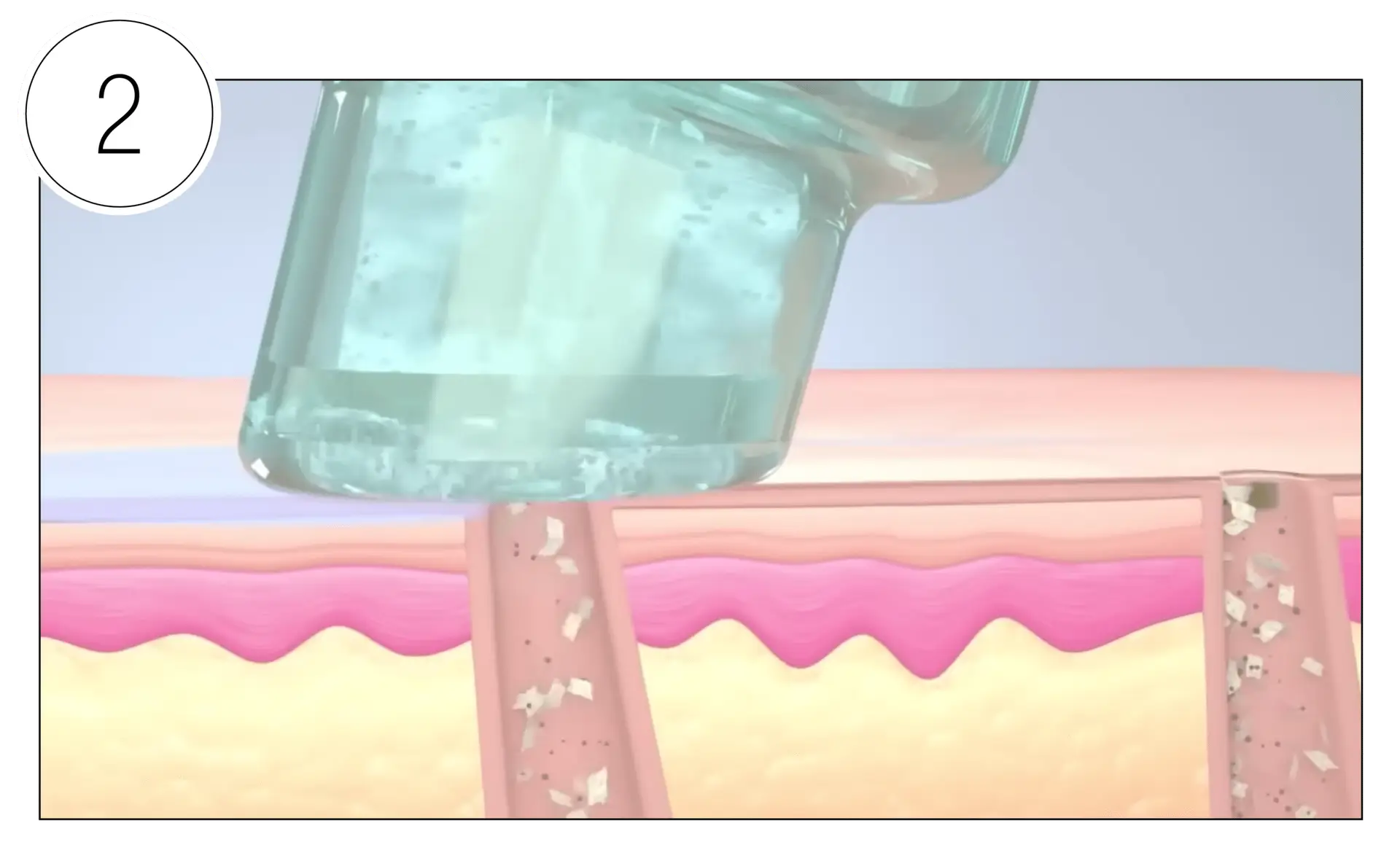 Skinney Medspa Treatments