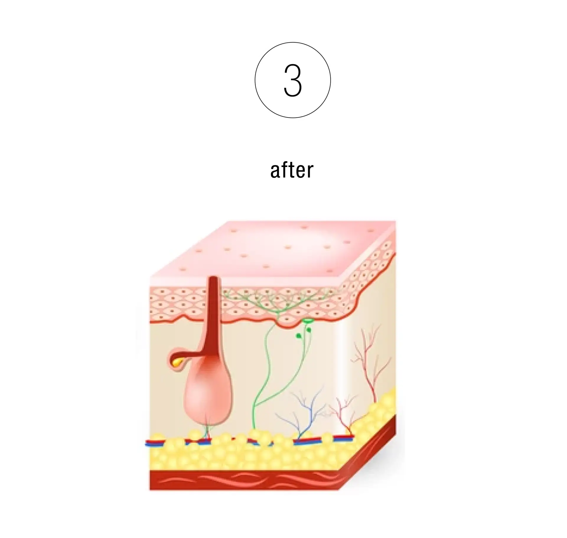 Skinney Medspa Treatments