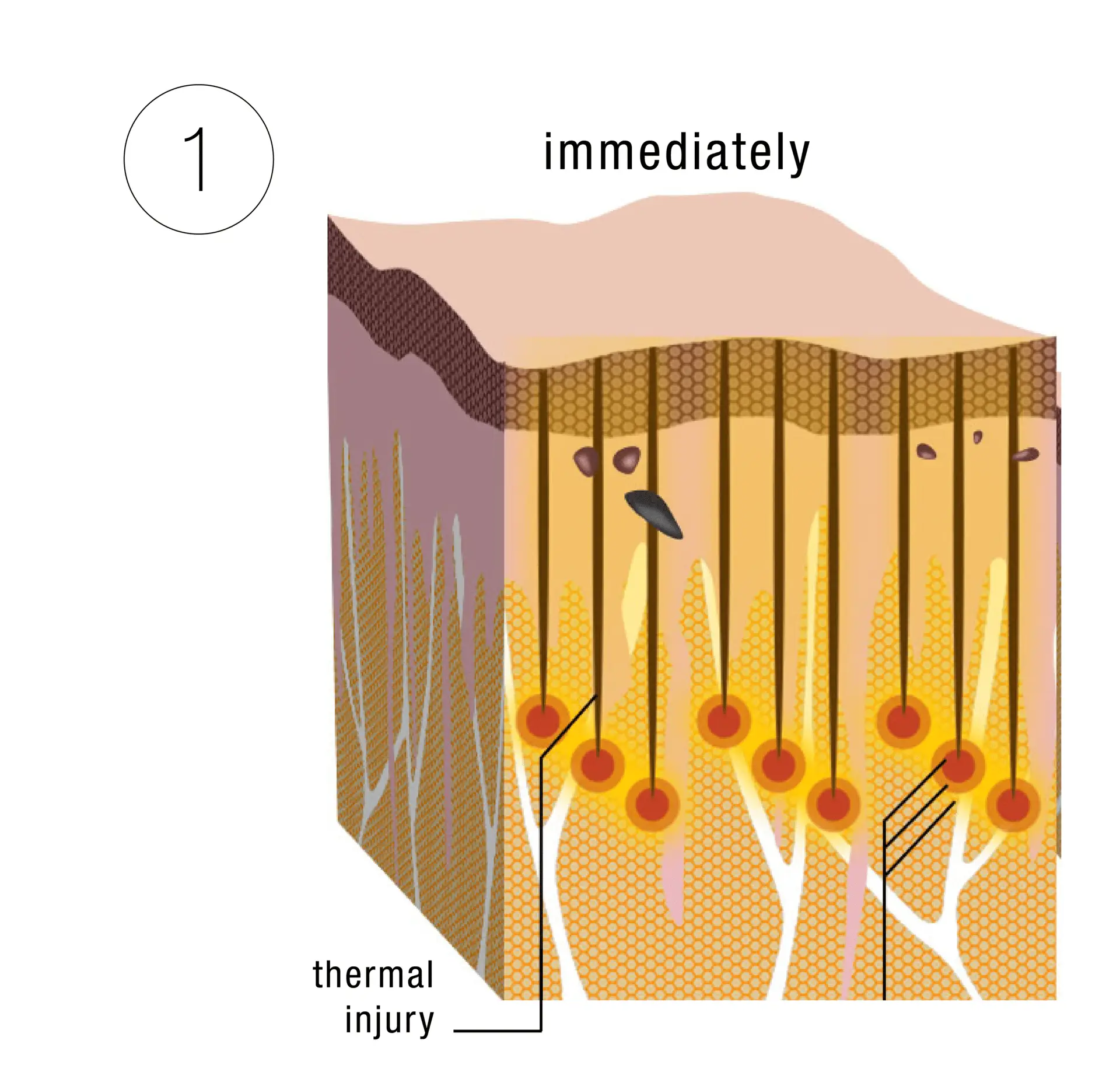 Skinney Medspa Treatments