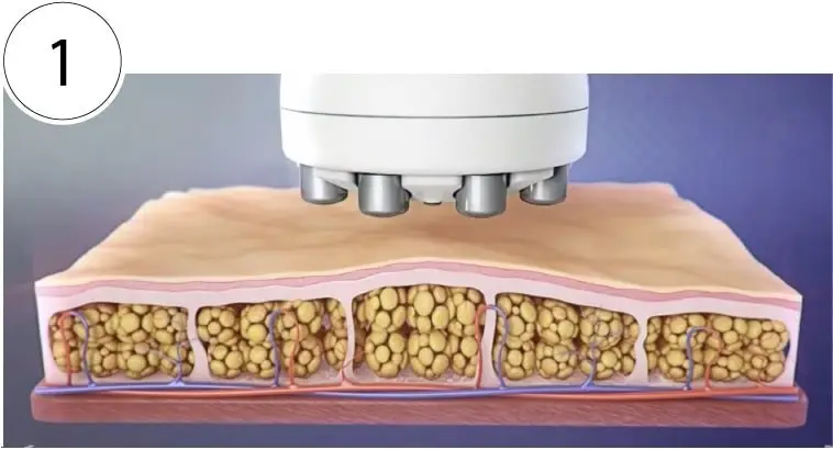 Skinney Medspa Treatments