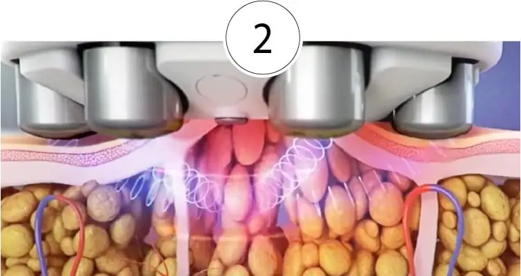 Skinney Medspa Treatments