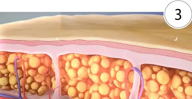 Skinney Medspa Treatments