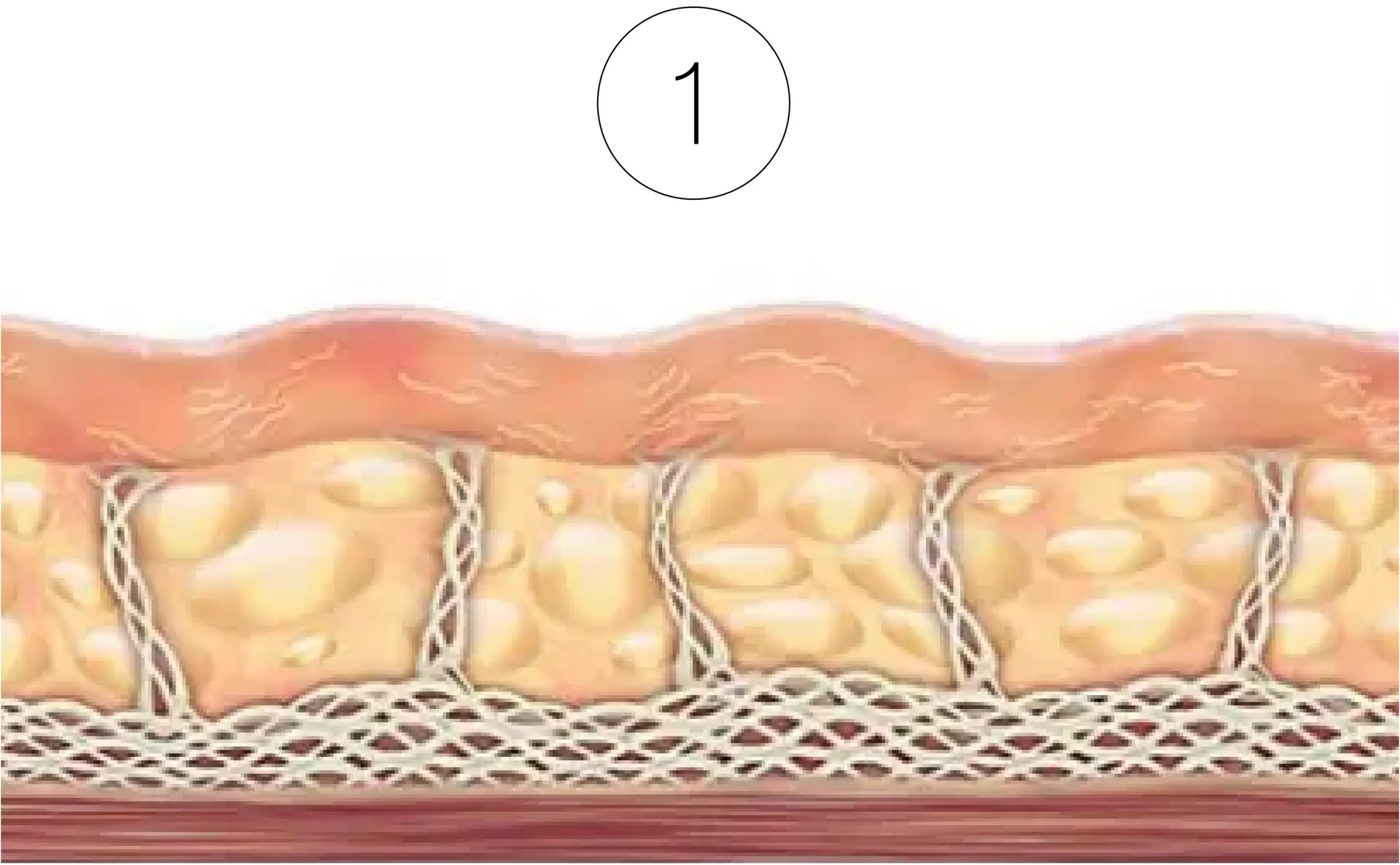 Skinney Medspa Treatments