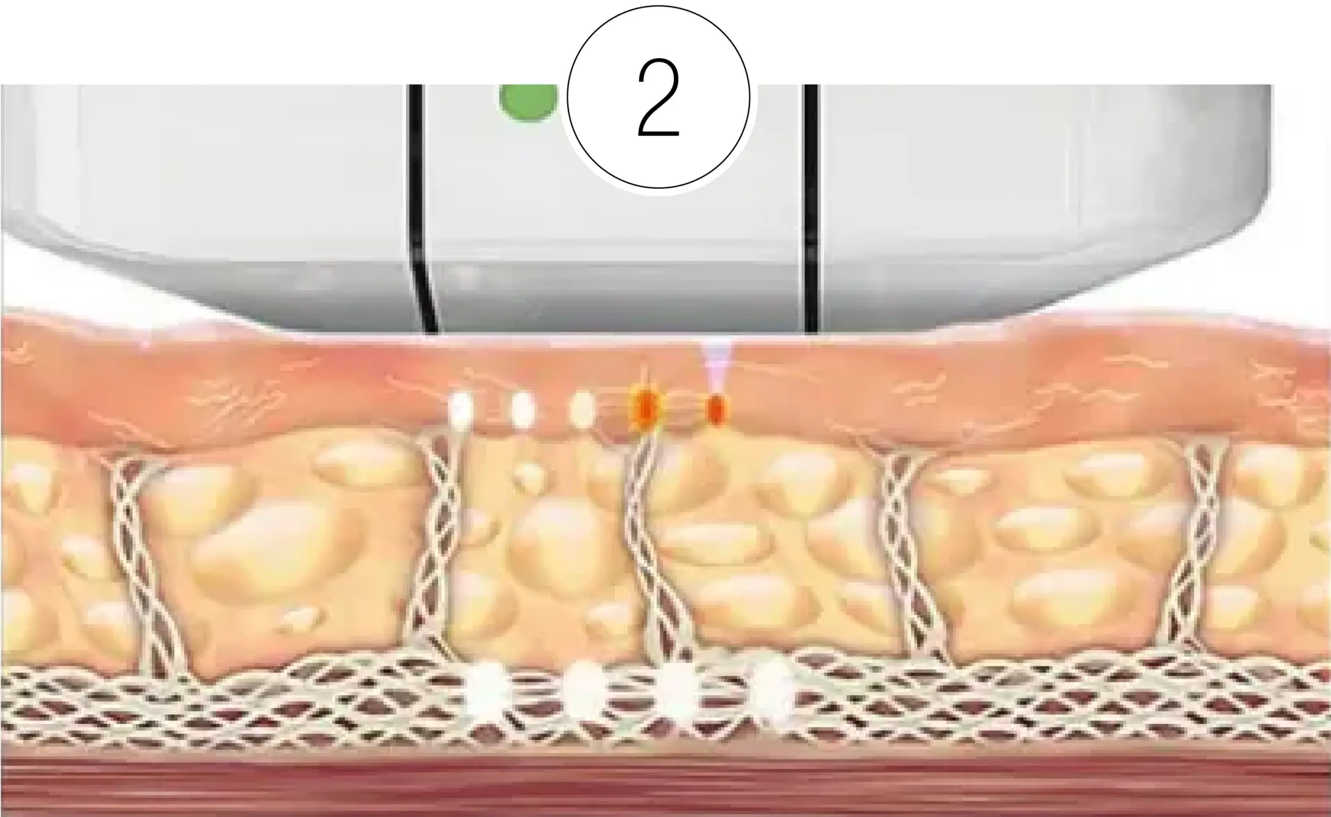 Skinney Medspa Treatments