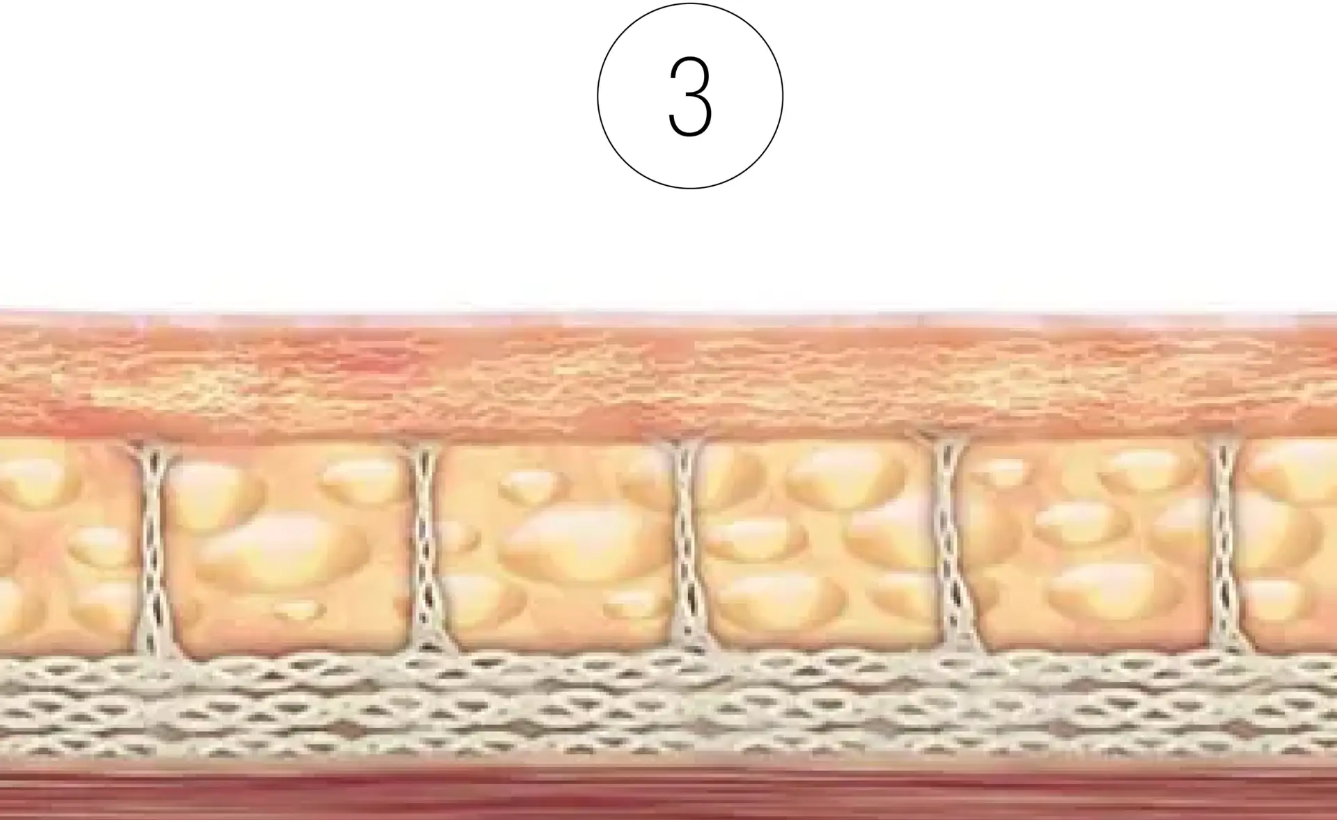 Skinney Medspa Treatments